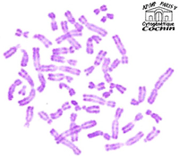 Photographie des chromosomes humains